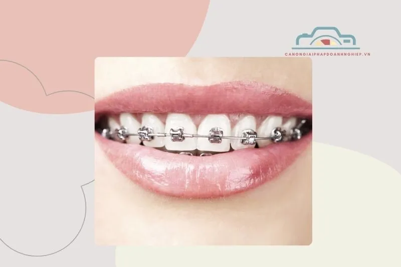 Nha khoa Sài Gòn Việt Mỹ